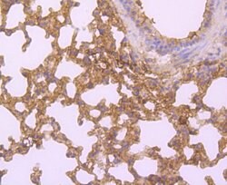 Invitrogen HLA-AB Polyclonal Antibody 100 &mu;L | Buy Online | Invitrogen&trade; | Fisher Scientific