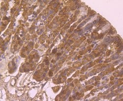 Invitrogen HLA-AB Polyclonal Antibody 100 &mu;L | Buy Online | Invitrogen&trade; | Fisher Scientific