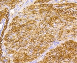 Invitrogen Filamin A Polyclonal Antibody 100 &mu;L; Unconjugated:Antibodies,