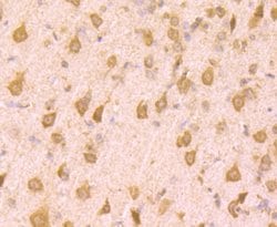 Invitrogen PCBP1 Polyclonal Antibody 100 &mu;L | Buy Online | Invitrogen&trade; | Fisher Scientific