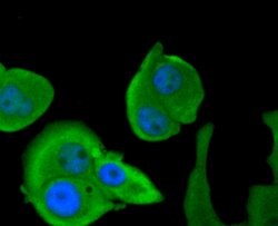 Invitrogen Calpain 1 Polyclonal Antibody 100 &mu;L | Buy Online | Invitrogen&trade; | Fisher Scientific