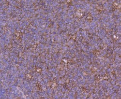 Invitrogen Calpain 1 Polyclonal Antibody 100 &mu;L | Buy Online | Invitrogen&trade; | Fisher Scientific