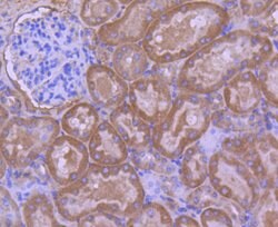 Invitrogen Calpain 1 Polyclonal Antibody 100 &mu;L | Buy Online | Invitrogen&trade; | Fisher Scientific