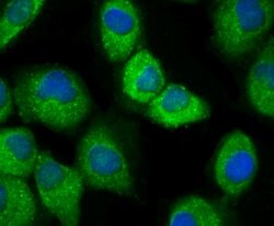 Invitrogen IKK beta Polyclonal Antibody 100 &mu;L; Unconjugated:Antibodies,
