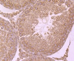 Invitrogen IKK beta Polyclonal Antibody 100 &mu;L; Unconjugated:Antibodies,