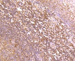 Invitrogen IKK beta Polyclonal Antibody 100 &mu;L; Unconjugated:Antibodies,