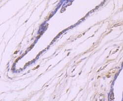 Invitrogen IKK beta Polyclonal Antibody 100 &mu;L; Unconjugated:Antibodies,