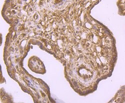 Invitrogen IKK beta Polyclonal Antibody 100 &mu;L; Unconjugated:Antibodies,