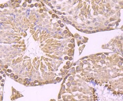 Invitrogen IKK beta Polyclonal Antibody 100 &mu;L; Unconjugated:Antibodies,