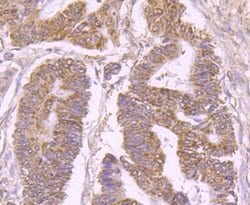 Invitrogen Bax Polyclonal Antibody 100 &mu;L; Unconjugated:Antibodies,
