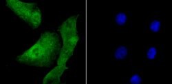 Invitrogen DDB1 Polyclonal Antibody 100 &mu;L; Unconjugated:Antibodies,