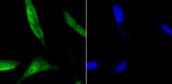 Invitrogen DDB1 Polyclonal Antibody 100 &mu;L; Unconjugated:Antibodies,