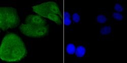 Invitrogen DDB1 Polyclonal Antibody 100 &mu;L; Unconjugated:Antibodies,