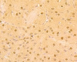 Invitrogen DDB1 Polyclonal Antibody 100 &mu;L; Unconjugated:Antibodies,