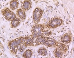 Invitrogen DDB1 Polyclonal Antibody 100 &mu;L; Unconjugated:Antibodies,