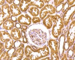 Invitrogen DDB1 Polyclonal Antibody 100 &mu;L; Unconjugated:Antibodies,