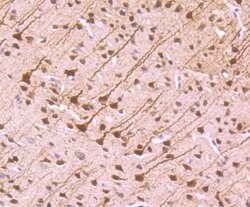 Invitrogen NFIB Polyclonal Antibody 100 &mu;L; Unconjugated:Antibodies,