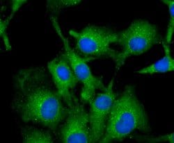 Invitrogen Tyrosinase Polyclonal Antibody 100 &mu;L; Unconjugated:Antibodies,