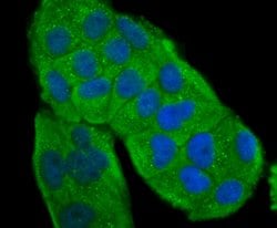Invitrogen Tyrosinase Polyclonal Antibody 100 &mu;L; Unconjugated:Antibodies,
