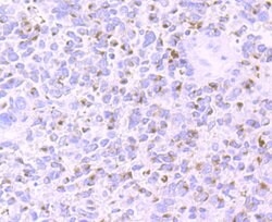 Invitrogen Tyrosinase Polyclonal Antibody 100 &mu;L; Unconjugated:Antibodies,