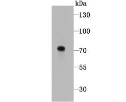 Invitrogen Tyrosinase Polyclonal Antibody 100 &mu;L; Unconjugated:Antibodies,