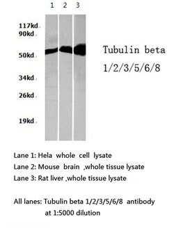 Invitrogen beta Tubulin Polyclonal Antibody 100 &mu;L | Buy Online | Invitrogen&trade; | Fisher Scientific