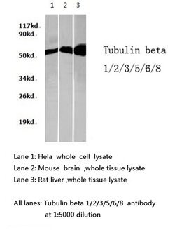 Invitrogen beta Tubulin Polyclonal Antibody 100 &mu;L | Buy Online | Invitrogen&trade; | Fisher Scientific