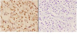 Invitrogen c-Abl Polyclonal Antibody 100 &mu;L | Buy Online | Invitrogen&trade; | Fisher Scientific