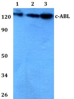 Invitrogen c-Abl Polyclonal Antibody 100 &mu;L | Buy Online | Invitrogen&trade; | Fisher Scientific