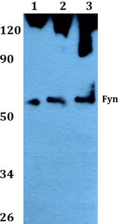 Invitrogen Fyn Polyclonal Antibody 100 &mu;L | Buy Online | Invitrogen&trade; | Fisher Scientific