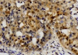 Invitrogen ETS1 Polyclonal Antibody 100 &mu;L; Unconjugated:Antibodies,