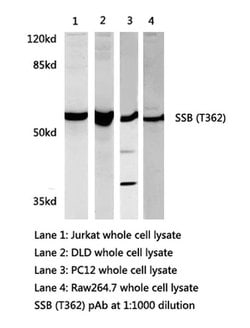 Invitrogen SSB Polyclonal Antibody 100 &mu;L; Unconjugated:Antibodies,