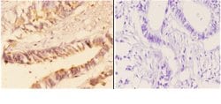 Invitrogen Acetylcholinesterase Polyclonal Antibody 100 &mu;L; Unconjugated:Antibodies,