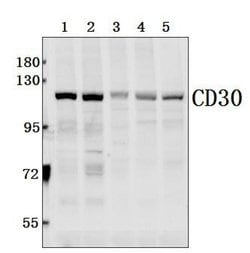 Invitrogen CD30 Polyclonal Antibody 100 &mu;L; Unconjugated:Antibodies,