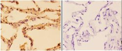 Invitrogen SQSTM1 Polyclonal Antibody 100 &mu;L; Unconjugated:Antibodies,
