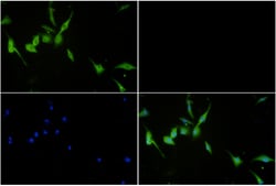 Invitrogen SQSTM1 Polyclonal Antibody 100 &mu;L; Unconjugated:Antibodies,