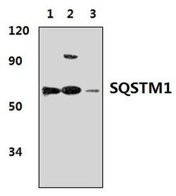 Invitrogen SQSTM1 Polyclonal Antibody 100 &mu;L; Unconjugated:Antibodies,
