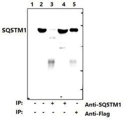 Invitrogen SQSTM1 Polyclonal Antibody 100 &mu;L; Unconjugated:Antibodies,