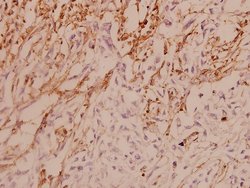 Invitrogen ASK1 Polyclonal Antibody 100 &mu;L; Unconjugated:Antibodies,