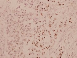 Invitrogen ATF4 Polyclonal Antibody 100 &mu;L; Unconjugated:Antibodies,