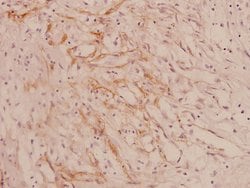 Invitrogen COL4A1 Polyclonal Antibody 100 &mu;L; Unconjugated:Antibodies,