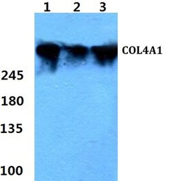 Invitrogen COL4A1 Polyclonal Antibody 100 &mu;L; Unconjugated:Antibodies,