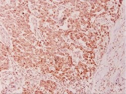 Invitrogen CAS Polyclonal Antibody 100 &mu;L; Unconjugated:Antibodies,