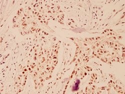 Invitrogen DP1 Polyclonal Antibody 100 &mu;L; Unconjugated:Antibodies,