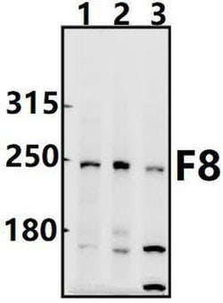 Invitrogen Factor VIII Polyclonal Antibody 100 &mu;L; Unconjugated:Antibodies,
