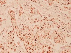 Invitrogen HDAC6 Polyclonal Antibody 100 &mu;L | Buy Online | Invitrogen&trade; | Fisher Scientific