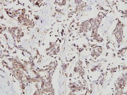 Invitrogen HDAC7 Polyclonal Antibody 100 &mu;L; Unconjugated:Antibodies,