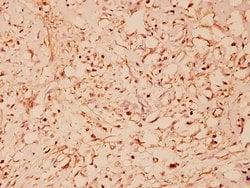 Invitrogen HSP60 Polyclonal Antibody 100 &mu;L; Unconjugated:Antibodies,