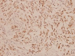 Invitrogen Involucrin Polyclonal Antibody 100 &mu;L; Unconjugated:Antibodies,