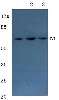 Invitrogen Involucrin Polyclonal Antibody 100 &mu;L; Unconjugated:Antibodies,